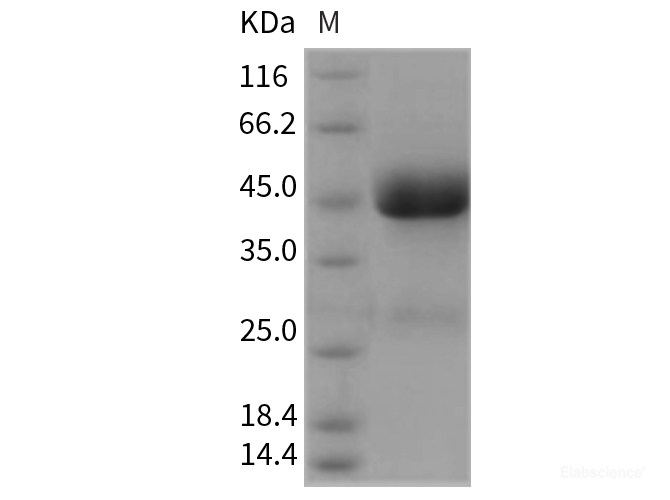 Recombinant Rat IL13RA2 / IL13R Protein (His tag)-Elabscience