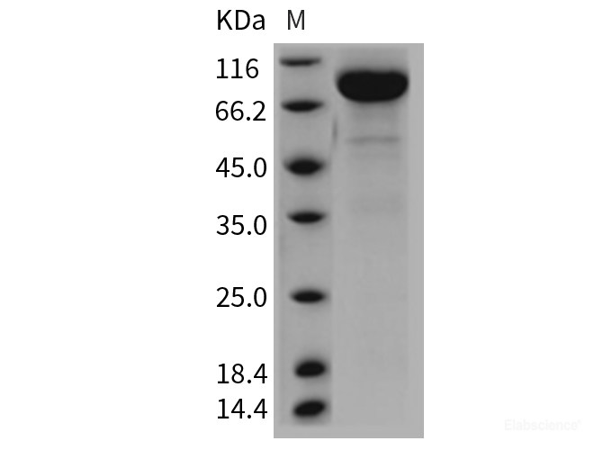 Recombinant Rat IL13RA2 / IL13R Protein (Fc tag)-Elabscience
