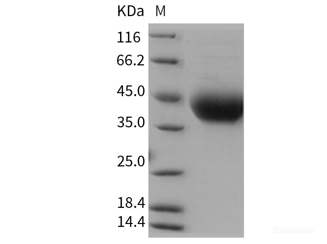 Recombinant Rat IL4R / Il4ra Protein (His tag)-Elabscience