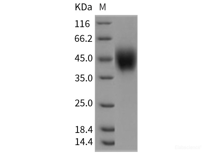 Recombinant Rat IL2RG / CD132 Protein (His tag)-Elabscience