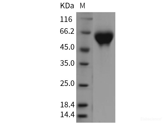 Recombinant Rat IL1R2 / IL1RB / CD121b Protein (His tag)-Elabscience