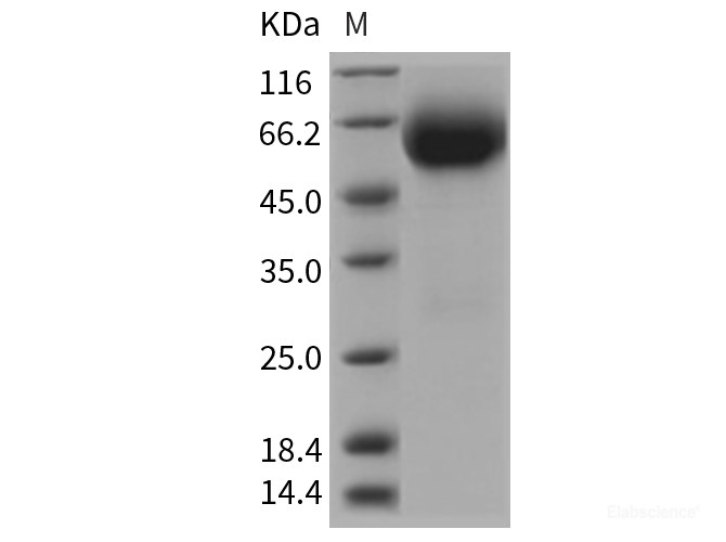 Recombinant Rat IL18R1 Protein (His tag)-Elabscience
