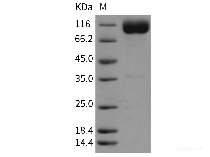 Recombinant Rat IL18R1 Protein (Fc tag)-Elabscience