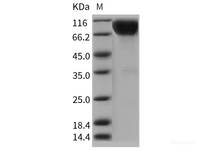 Recombinant Rat IL17RA / IL17R Protein (Fc tag)-Elabscience