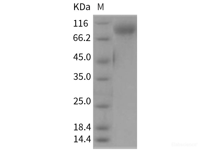 Recombinant Rat IL13RA1 Protein (Fc tag)-Elabscience