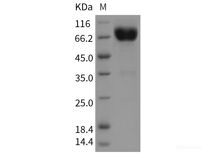 Recombinant Rat IL10RB / IL10R2 Protein (Fc tag)-Elabscience