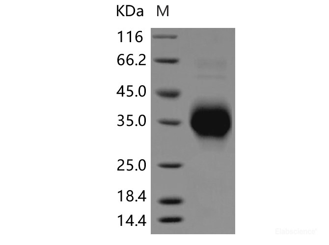 Recombinant Rat TNFR1 / CD120a / TNFRSF1A Protein (His tag)-Elabscience