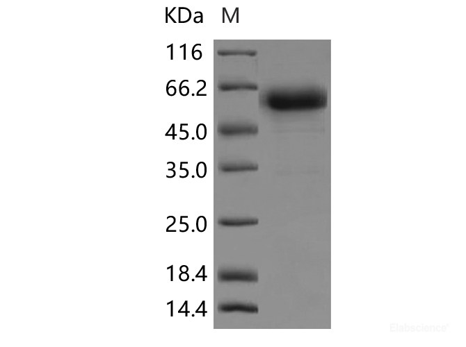Recombinant Rat TNFR1 / CD120a / TNFRSF1A Protein (Fc tag)-Elabscience