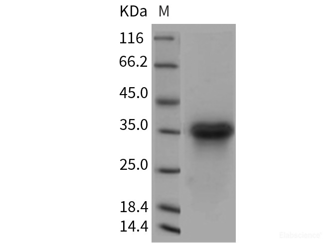 Recombinant Rat LTBR / TNFRSF3 Protein (His tag)-Elabscience