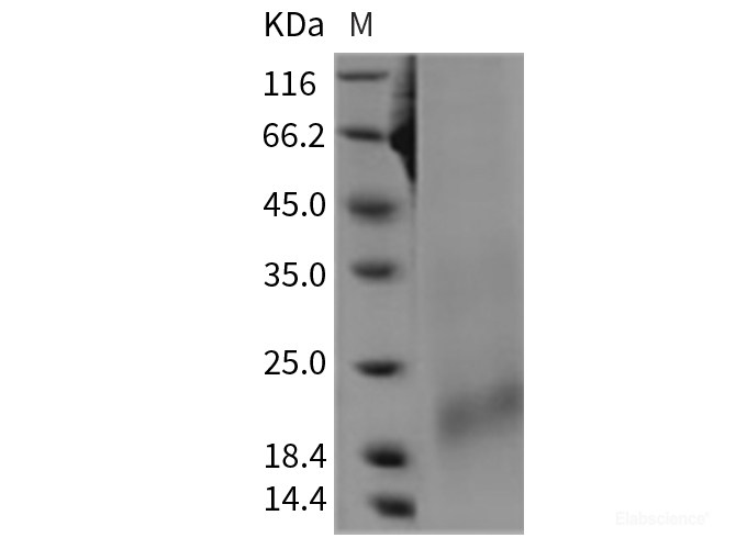 Recombinant Rat BAFFR / TNFRSF13C Protein (His tag)-Elabscience