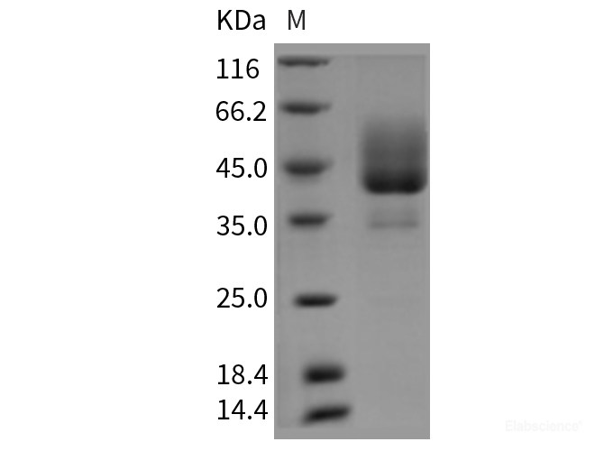 Recombinant Rat BAFFR / TNFRSF13C Protein (Fc tag)-Elabscience