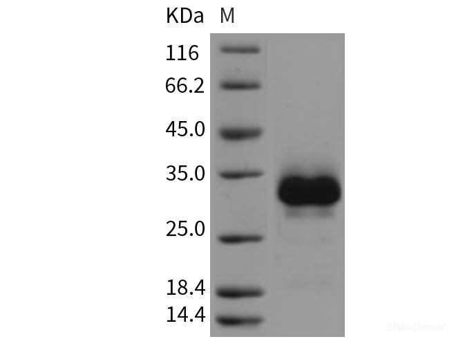 Recombinant Rat TNFRSF11A Protein (His tag)-Elabscience