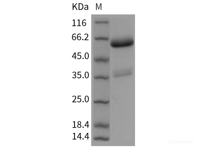 Recombinant Rat TNFRSF11A Protein (Fc tag)-Elabscience