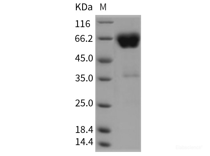 Recombinant Rat CD2 Protein (Fc tag)-Elabscience