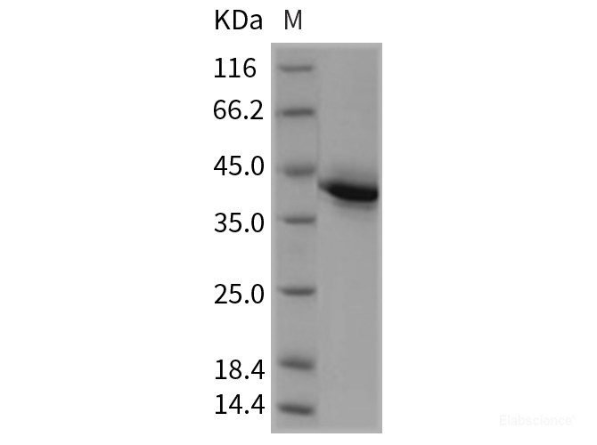 Recombinant Rat TNFRSF17 / BCMA Protein (Fc tag)-Elabscience