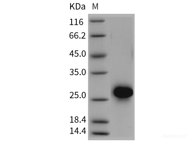 Recombinant Rat CD40 / TNFRSF5 Protein (His tag)-Elabscience