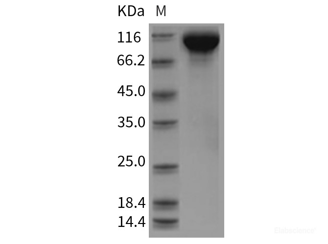 Recombinant Rat EGFR / HER1 / ErbB1 Protein (His tag)-Elabscience