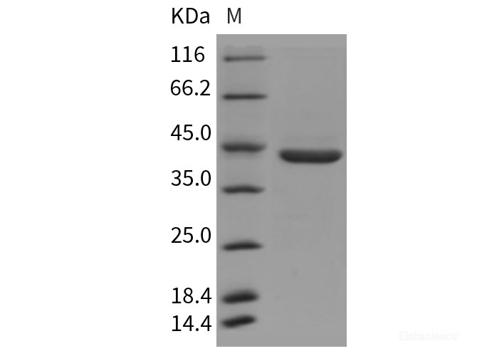 Recombinant Rat Pepsinogen C / PGC Protein (His tag)-Elabscience