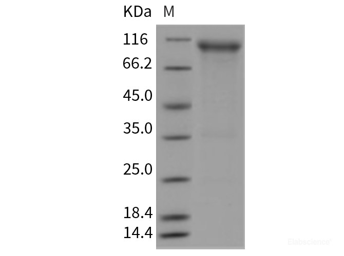 Recombinant Rat FGFR4 / FGF Receptor 4 Protein (Fc tag)-Elabscience