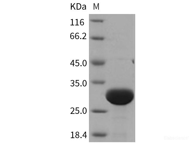 Recombinant Rat UCHL3 Protein (His tag)-Elabscience