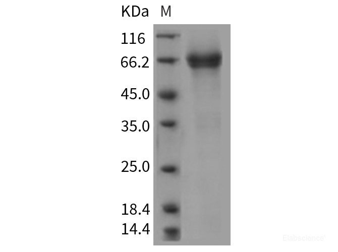 Recombinant Rat IL7R / IL7RA Protein (Fc tag)-Elabscience