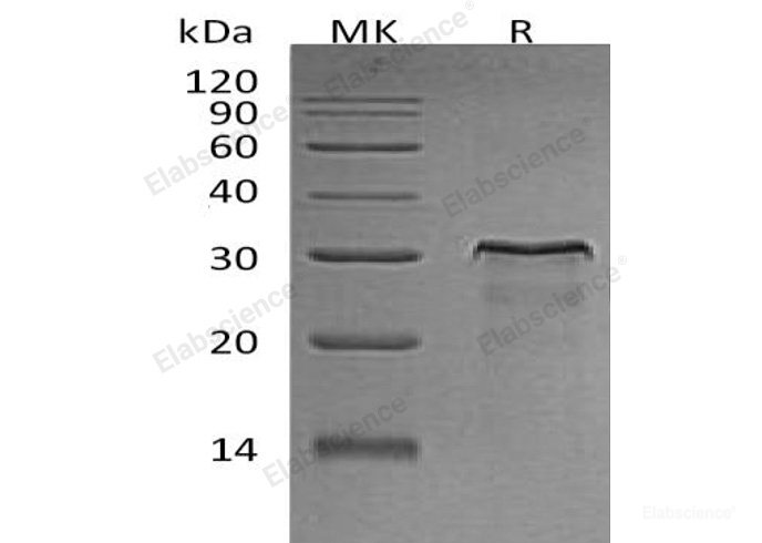 Recombinant Rat Her2 / ERBB2 Protein (His Tag)-Elabscience