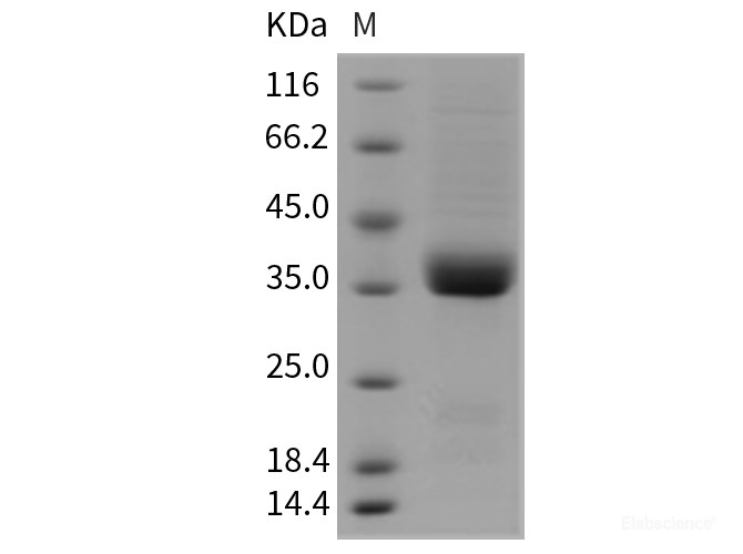 Recombinant Rat IL9R / Interleukin 9 receptor Protein (His tag)-Elabscience
