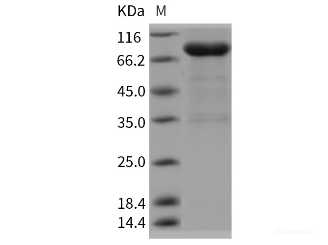 Recombinant Rat UNC5B / UNC5H2 Protein (Fc tag)-Elabscience