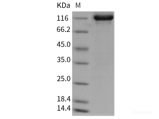 Recombinant Rat Tie2 / TEK Protein (Fc tag)-Elabscience