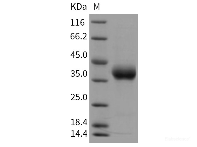 Recombinant Rat PRLR / Prolactin receptor Protein (His tag)-Elabscience
