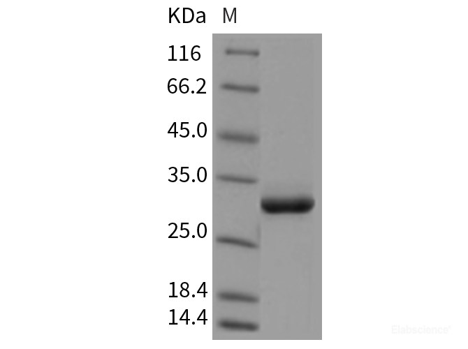 Recombinant Rat Serum amyloid P component / APCS / SAP Protein (His tag)-Elabscience