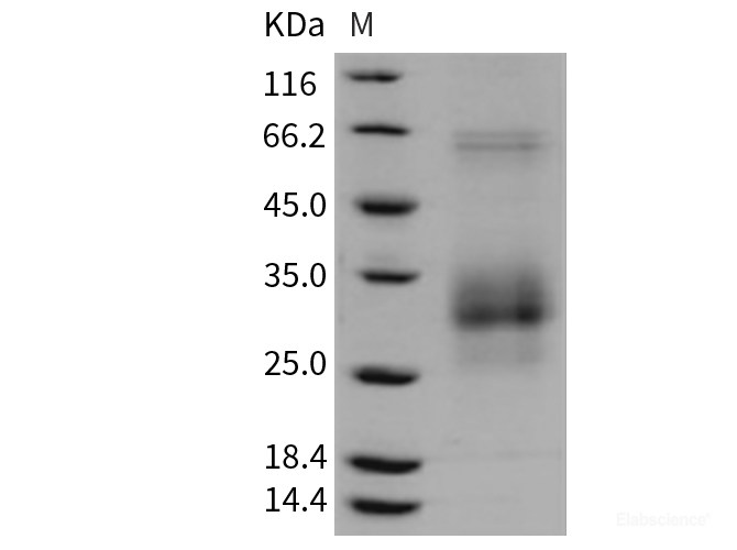 Recombinant Rat FAS / CD95 / APO-1 / TNFRSF6 Protein (His tag)-Elabscience