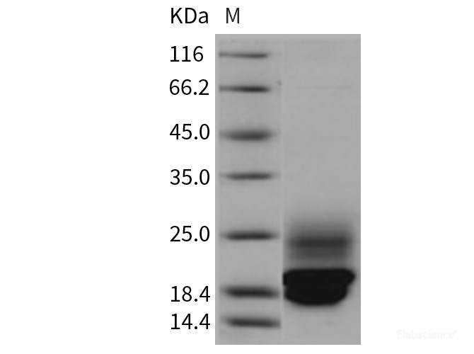 Recombinant Rat Cystatin C / CST3 Protein (His tag)-Elabscience