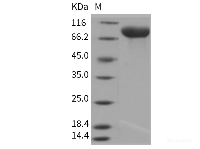 Recombinant Rat gp130 / IL6ST / CD130 Protein (His tag)-Elabscience