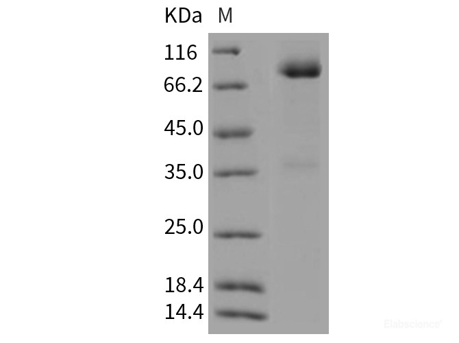 Recombinant Rat GFRA1 / GFR alpha-1 Protein (Fc tag)-Elabscience
