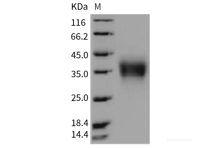 Recombinant Rat CD32b / FCGR2B Protein (His tag)-Elabscience