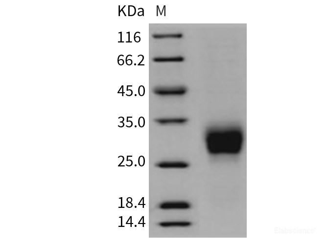 Recombinant Rat CD16a / FCGR3A Protein (His tag)-Elabscience