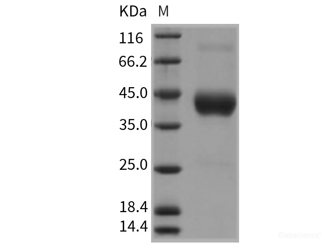 Recombinant Rat CD64 / FCGR1A Protein (His tag)-Elabscience