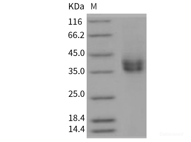 Recombinant Rat CD89 / FCAR Protein (His tag)-Elabscience