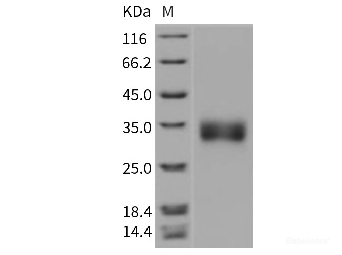 Recombinant Rat Sclerostin / SOST Protein (His tag)-Elabscience