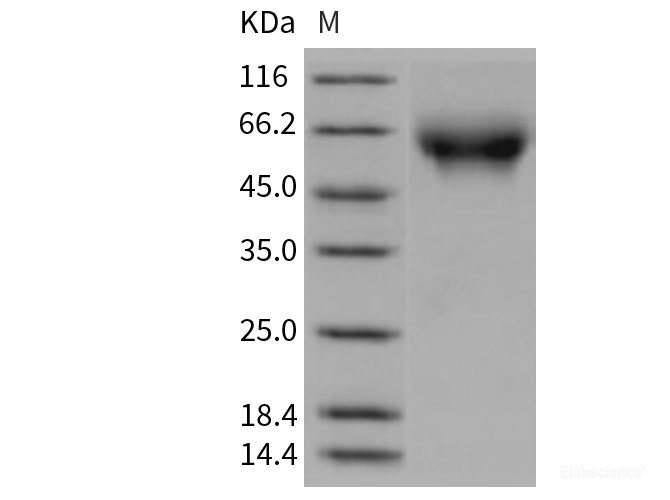 Recombinant Rat CD155 / PVR / NECL5 Protein (His tag)-Elabscience