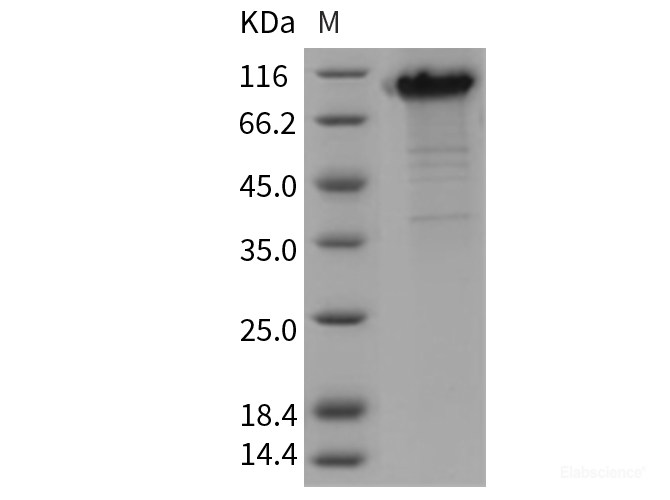 Recombinant Rat KIM-1 / TIM1 / HACVR1 Protein (His & Fc tag)-Elabscience