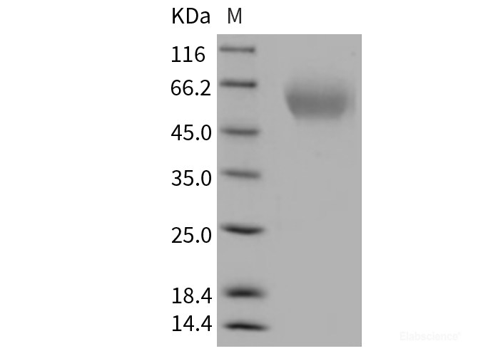 Recombinant Rat KIM-1 / TIM1 / HACVR1 Protein (His tag)-Elabscience