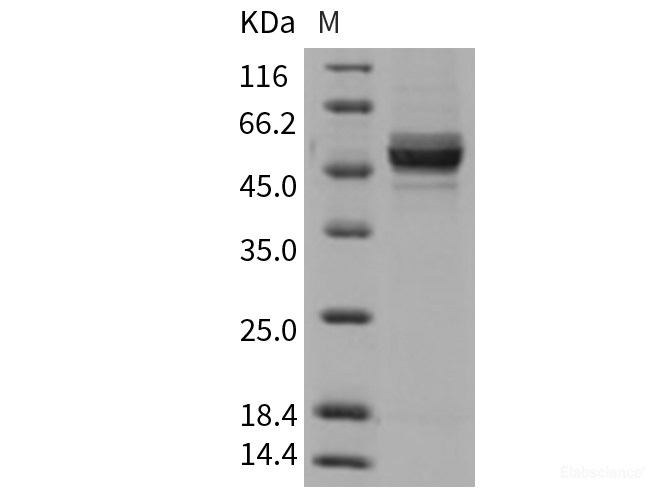 Recombinant Rat GPT2 Protein (His tag)-Elabscience