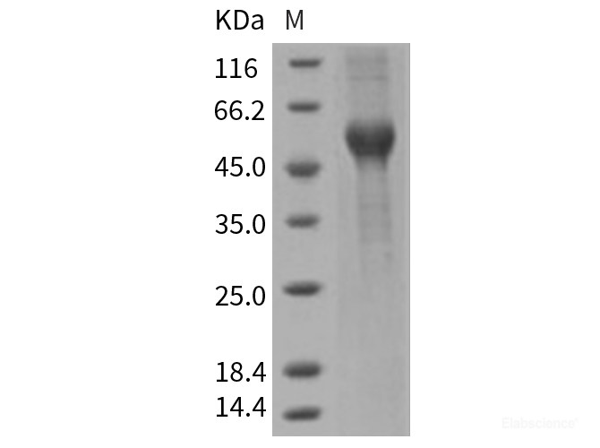 Recombinant Rat ALK-1 / ACVRL1 Protein (His & Fc tag)-Elabscience