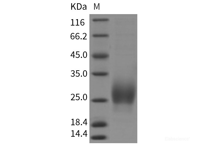 Recombinant Rat CTLA-4 / CD152 Protein (ECD, His tag)-Elabscience