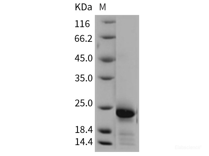 Recombinant Rat IL6 / Interleukin-6 Protein-Elabscience