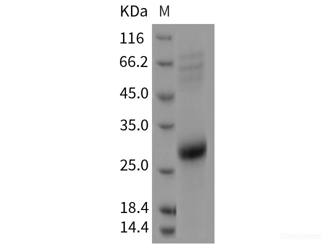 Recombinant Rat CD70 / CD27L / TNFSF7 Protein (His Tag)-Elabscience