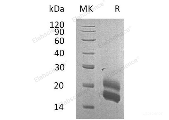 Recombinant Rat Granulocyte-Macrophage Colony-Stimulating Factor/GM-CSF Protein(C-6His) -Elabscience
