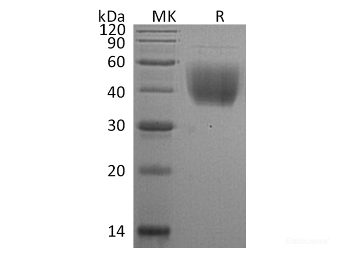 Recombinant Rat T-lymphocyte Activation Antigen CD80/B7-1 Protein(C-6His) -Elabscience